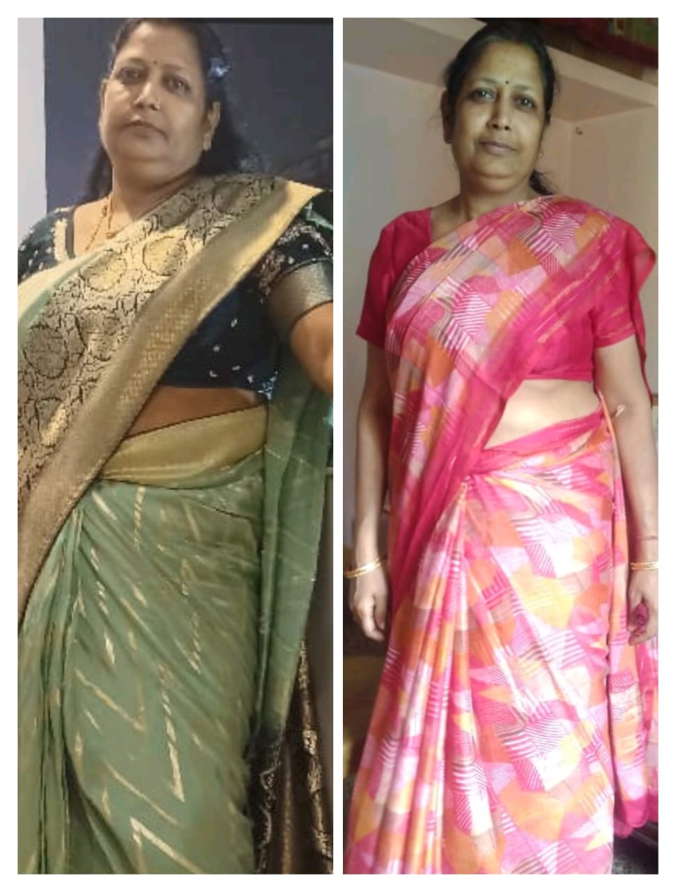Waistline Reduction Transformation